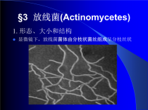 放线菌?放线菌是细菌还是真菌!